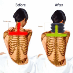 Cervical Neck Traction Device Collar Brace Support Pain Relief Stretcher Therapy - Image 15