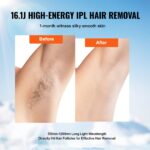 VEVOR IPL Hair Removal, Permanent Hair Removal with Ice Cooling System for Women Men, Auto/Manual Modes & 5 Levels, Painless At-Home Hair Removal Device for Legs, Arms, Armpits, Bikini Line - Image 3