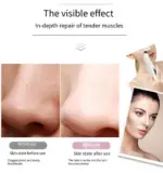 Electric Facial Pore Vacuum Blackhead Remover with 3 Suction Levels and 3 Heads - Image 11