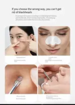 Electric Facial Pore Vacuum Blackhead Remover with 3 Suction Levels and 3 Heads - Image 13