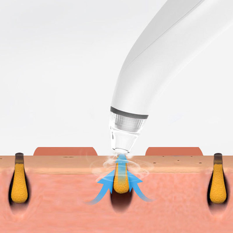 Electric Facial Pore Vacuum Blackhead Remover with 3 Suction Levels and 3 Heads