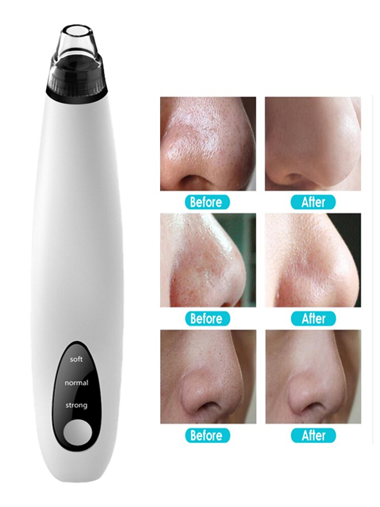 Electric Facial Pore Vacuum Blackhead Remover with 3 Suction Levels and 3 Heads