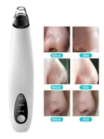 Electric Facial Pore Vacuum Blackhead Remover with 3 Suction Levels and 3 Heads - Image 3